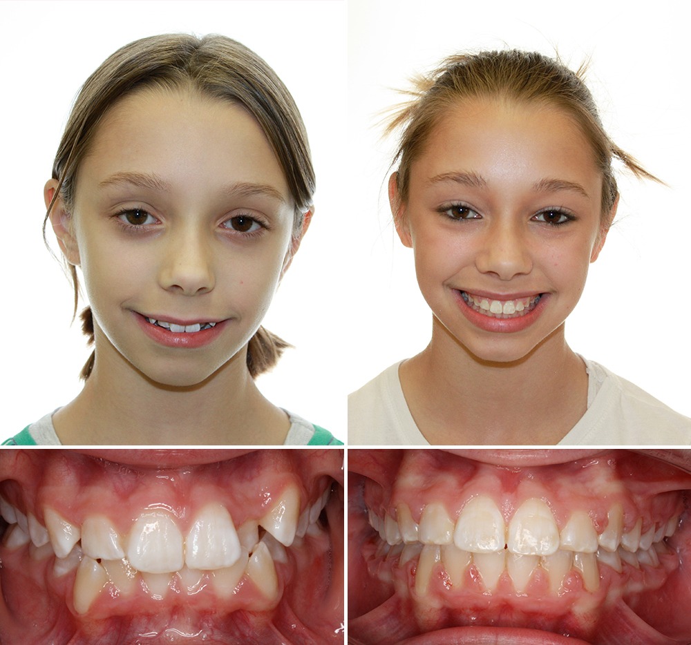 patient before and after photos