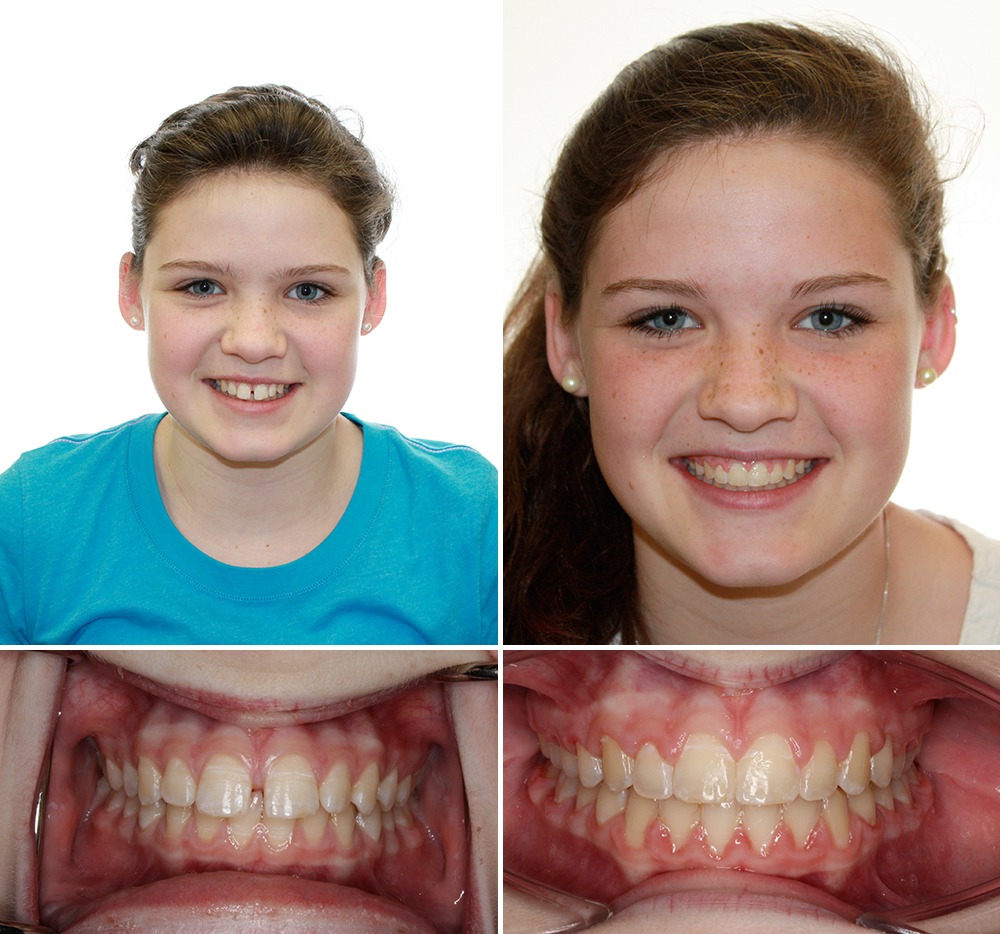 patient before and after photos