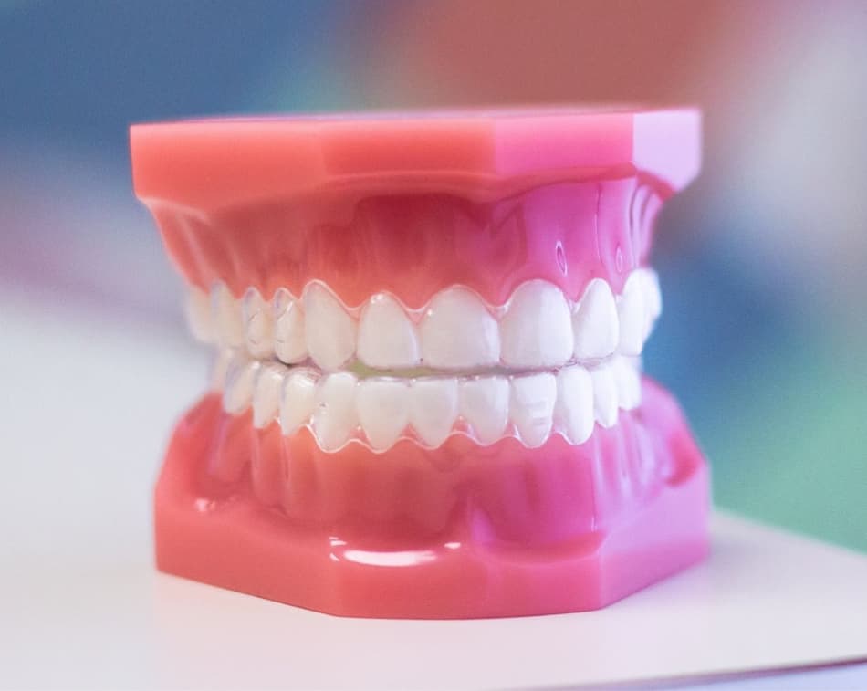 invisalign aligners on plastic typodont