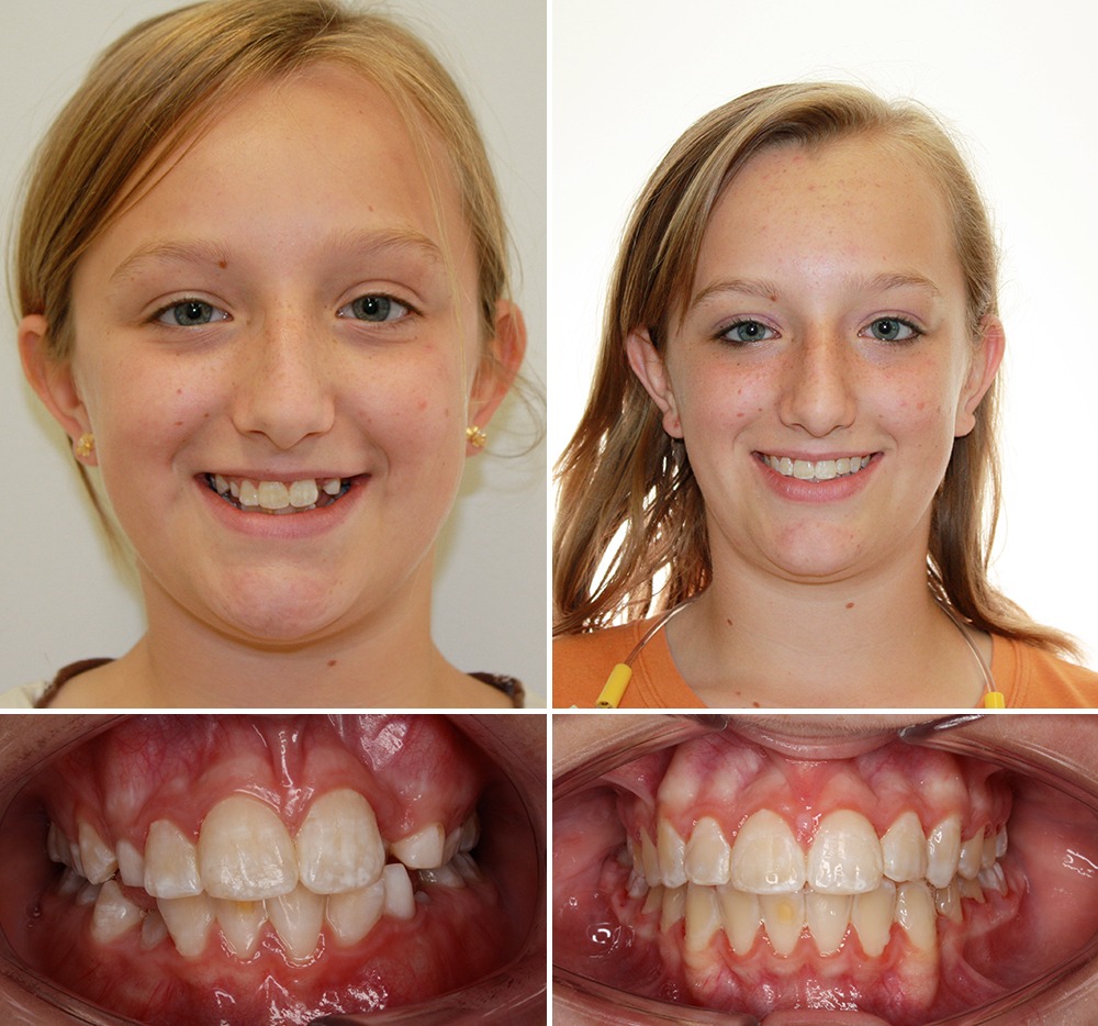 patient before and after photos