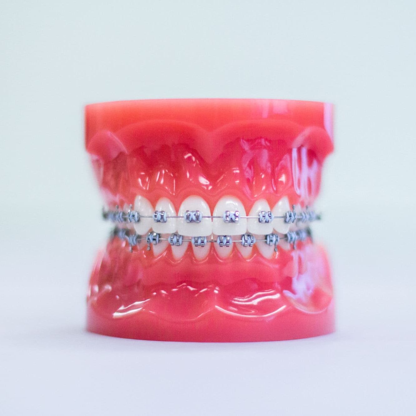 Model of teeth with traditional metal braces, showcasing orthodontic treatment options at Bowen Family Orthodontics for Mullica Hill and surrounding areas.